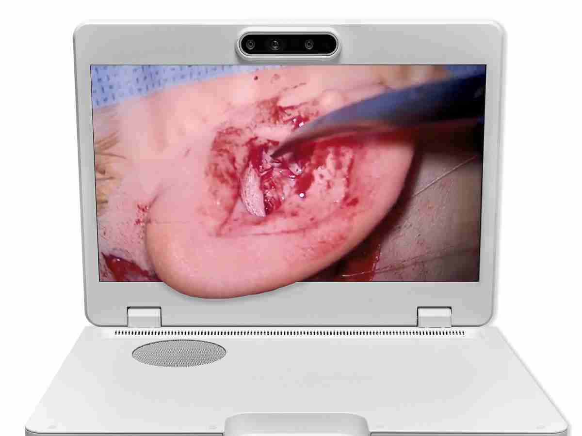 达擎之＂Heads-up 3D显微手术显示系统＂，，整合4K裸眼3D显示及眼球追踪系统，，，，具备快速追踪人眼移动位置功能，，，减轻医师长时间维持固定姿势的负担，，，让医师能有更宽广清晰的3D立体视野及更舒适的姿势来执行手术。。